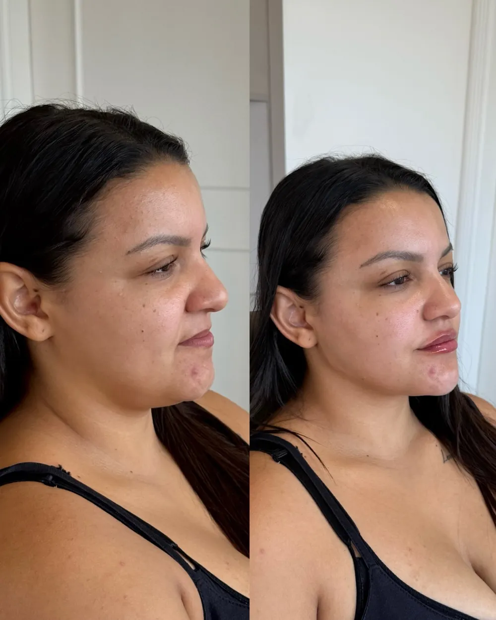 Caso 03: antes e depois, segundo ângulo