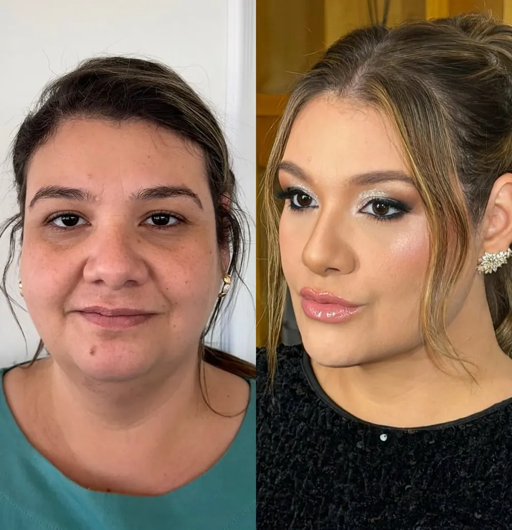 Caso 13: antes e depois, segundo ângulo